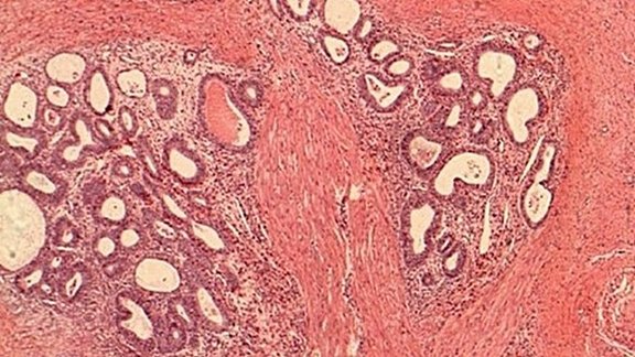 endo_histo.jpeg