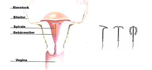 kupferspirale.jpeg