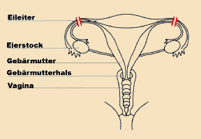 sterilisation.gif