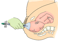 vakuum1.gif 